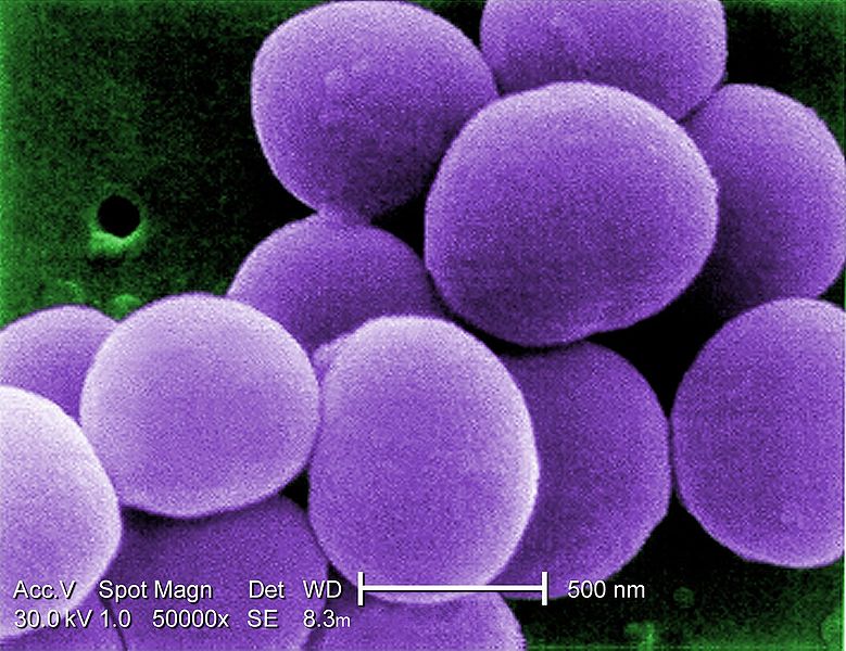 Antimicrobial resistance and molecular epidemiology of Staphylococcus aureus from Mongolia