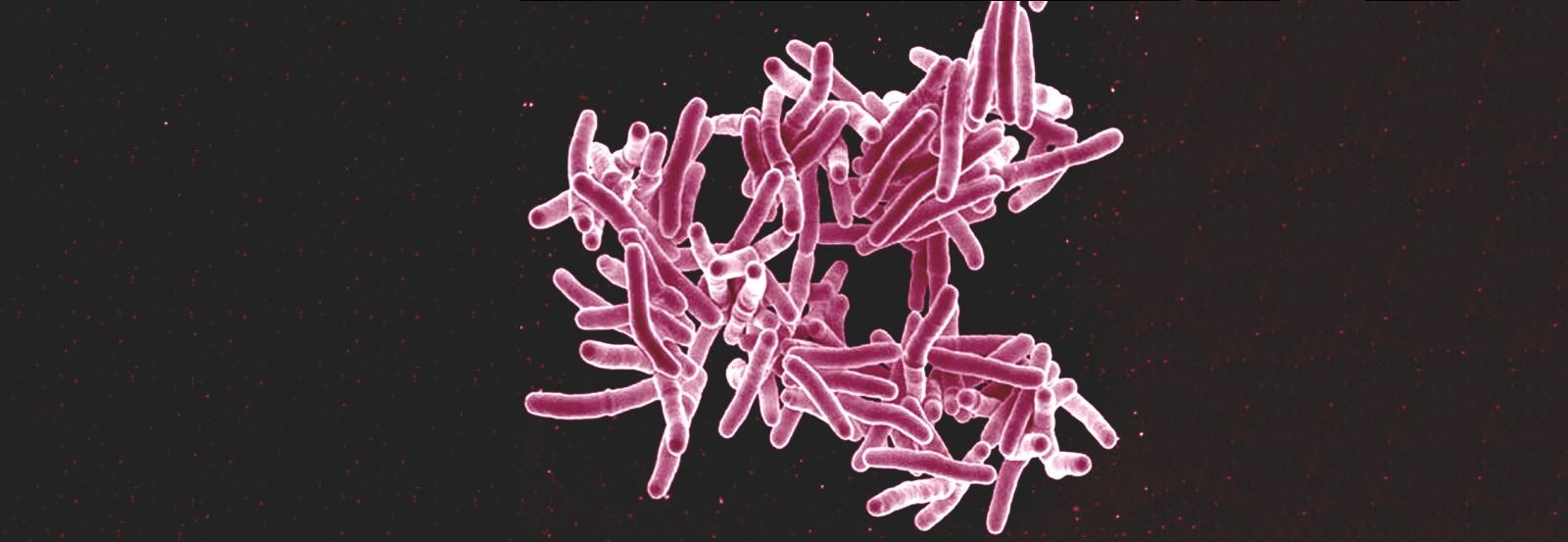 Using shotgun metagenomics to diagnose tuberculosis